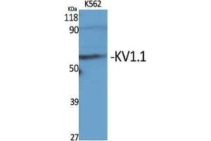 Western Blot (WB) analysis of specific cells using KV1. (KCNA1 antibody  (Internal Region))