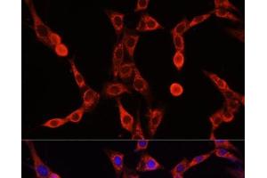 Immunofluorescence analysis of NIH/3T3 cells using ABCD1 Polyclonal Antibody at dilution of 1:100.