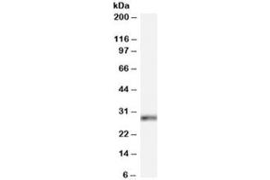 Western blot testing of HeLa cell lysate with HOXB13 antibody at 0.