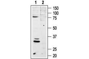 Western Blotting (WB) image for anti-Melanocortin 4 Receptor (MC4R) (AA 6-20), (Extracellular) antibody (ABIN7043324)