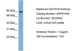 WB Suggested Anti-KCTD16  Antibody Titration: 0. (KCTD16 antibody  (N-Term))