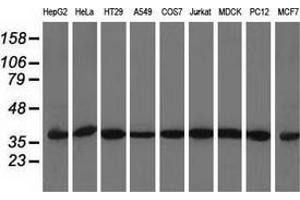 Western blot analysis of extracts (35 µg) from 9 different cell lines by using anti-ACAT2 monoclonal antibody.
