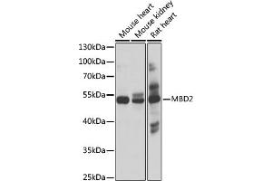 Western blot analysis of extracts of various cell lines, using MBD2 antibody (ABIN1680781, ABIN3015876, ABIN3015877 and ABIN6219461) at 1:1000 dilution. (MBD2 antibody  (AA 202-411))
