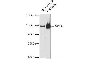 Western blot analysis of extracts of various cell lines using RASEF Polyclonal Antibody at dilution of 1:3000. (RASEF antibody)