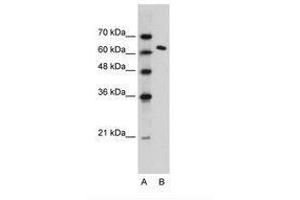 Image no. 1 for anti-FACT complex subunit SPT16 (SUPT16H) (AA 77-126) antibody (ABIN203368) (SUPT16H antibody  (AA 77-126))