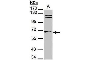 WB Image Sample(30 μg of whole cell lysate) A:Hep G2, 7. (TXNRD1 antibody)