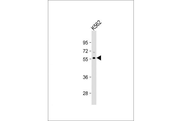 C1orf38 antibody  (C-Term)