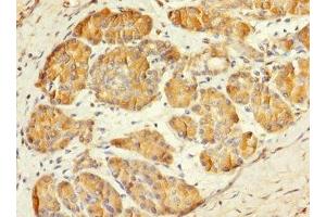 Immunohistochemistry of paraffin-embedded human pancreatic tissue using ABIN7159422 at dilution of 1:100 (MESP1 antibody  (AA 149-268))