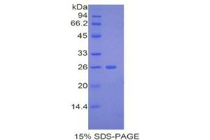 SDS-PAGE analysis of Mouse ADAMTS12 Protein.