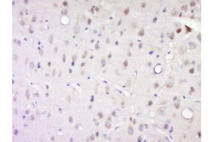 Paraformaldehyde-fixed, paraffin embedded rat brain, Antigen retrieval by boiling in sodium citrate buffer (pH6) for 15min, Block endogenous peroxidase by 3% hydrogen peroxide for 30 minutes, Blocking buffer (normal goat serum) at 37°C for 20min, Antibody incubation with Casein Kinase 1 alpha (Tyr294) Antibody, Unconjugated  at 1:200 overnight at 4°C, followed by a conjugated secondary and DAB staining. (CSNK1A1 antibody  (pTyr294))