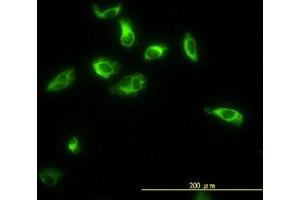 Image no. 4 for anti-Thiopurine S-Methyltransferase (TPMT) (AA 1-246) antibody (ABIN598985) (TPMT antibody  (AA 1-246))