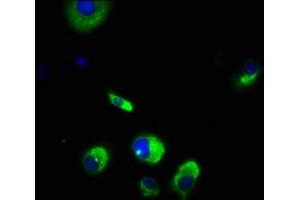 Immunofluorescence staining of MCF-7 cells with ABIN7175718 at 1:166, counter-stained with DAPI. (WDPCP antibody  (AA 621-737))
