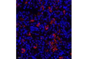 Immunofluorescence of paraffin embedded rat hypophysis using TSH (ABIN7075906) at dilution of 1:400 (400x lens) (TSHB antibody)