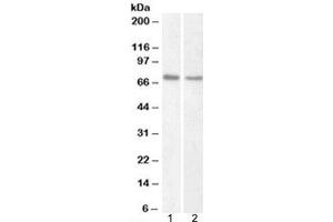 Western blot testing of human 1) HeLa and 2) Jurkat nuclear fraction lysate with Lamin B1 antibody at 1ug/ml. (Lamin B1 antibody)