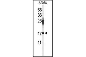 Western blot analysis in A2058 cell line lysates (35 ug/lane) using RPS11 Antibody (Center) Cat.