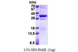 Stathmin-Like 4 (STMN4) (AA 1-216) protein (His tag)