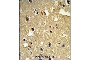 Formalin-fixed and paraffin-embedded human brain tissue reacted with TBB1 Antibody, which was peroxidase-conjugated to the secondary antibody, followed by DAB staining. (TUBB1 antibody)