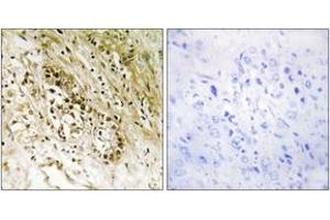 Immunohistochemistry analysis of paraffin-embedded human heart tissue, using PDZD2 Antibody. (PDZD2 antibody  (AA 51-100))