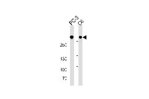 FLNA Antibody (ABIN1882243 and ABIN2838478) western blot analysis in PC-3 and C6 cell line lysates (35 μg/lane).