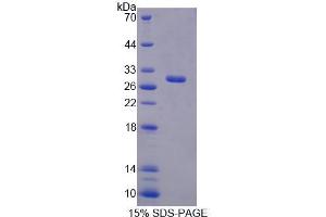 SDS-PAGE analysis of Mouse RFC4 Protein. (RFC4 Protein)