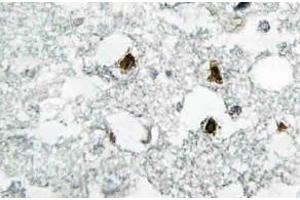 Immunohistochemistry (IHC) analyzes of p27 antibody in paraffin-embedded human brain tissue. (CDKN1B antibody)