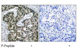 Image no. 1 for anti-Heat Shock Factor Protein 1 (HSF1) (pSer303) antibody (ABIN197024) (HSF1 antibody  (pSer303))