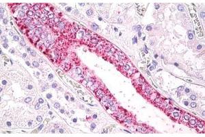 Human Kidney: Formalin-Fixed, Paraffin-Embedded (FFPE) (FFAR2 antibody  (Cytoplasmic Domain))