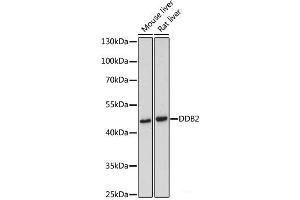 Western blot analysis of extracts of various cell lines using DDB2 Polyclonal Antibody at dilution of 1:500. (DDB2 antibody)