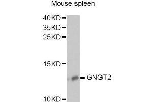 Western blot analysis of extracts of mouse spleen, using GNGT2 antibody (ABIN6292958) at 1:1000 dilution. (GNGT2 antibody)