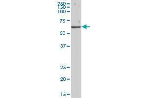 CES1 MaxPab polyclonal antibody. (CES1 antibody  (AA 1-566))
