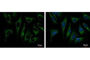 ICC/IF Image TRAP1 antibody detects TRAP1 protein at mitochondria by immunofluorescent analysis. (TRAP1 antibody)