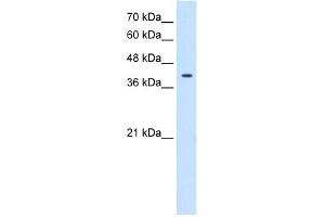 WB Suggested Anti-TSPAN12 Antibody Titration:  0.