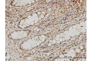 Image no. 1 for anti-Microtubule-Associated Protein, RP/EB Family, Member 2 (MAPRE2) (AA 1-63) antibody (ABIN466174) (MAPRE2 antibody  (AA 1-63))