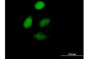 Immunofluorescence of purified MaxPab antibody to ZFP276 on HeLa cell. (ZNF276 antibody  (AA 1-373))