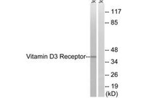 Western blot analysis of extracts from Jurkat cells, using Vitamin D3 Receptor (Ab-51) Antibody. (Vitamin D Receptor antibody  (AA 16-65))