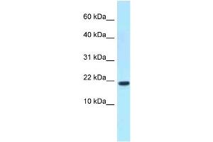 XAGE1D 抗体  (C-Term)