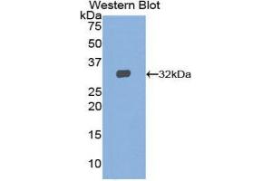 Western Blotting (WB) image for anti-Signal Transducer and Activator of Transcription 2, 113kDa (STAT2) (AA 658-912) antibody (ABIN1860647) (STAT2 antibody  (AA 658-912))