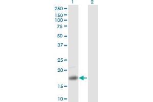 Western Blot analysis of PTN expression in transfected 293T cell line by PTN monoclonal antibody (M01), clone 5C3. (Pleiotrophin antibody  (AA 45-154))