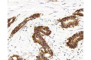 Immunohistochemistry analysis of paraffin-embedded human colon using Na+/K+-ATPase alpha1 Polyclonal Antibody at dilution of 1:300. (ATP1A1 antibody)