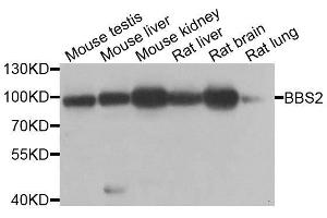 Western blot analysis of extracts of various cell lines, using BBS2 antibody. (BBS2 antibody  (AA 1-96))