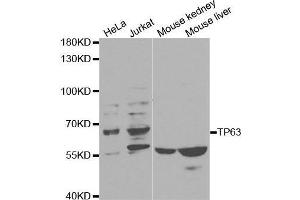 Western blot analysis of extracts of various cell lines, using TP63 antibody.