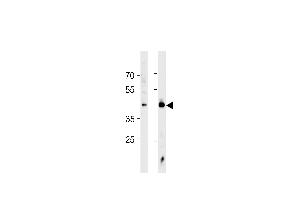HSF1 Antibody (ABIN389069 and ABIN2839273) western blot analysis in Jurkat cell line and mouse heart tissue lysates (35 μg/lane). (HSF1 antibody  (Sumoylation Site))