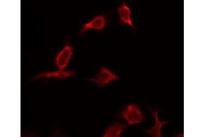 Immunofluorescence (fixed cells) (IF/ICC) image for anti-Caspase 9, Apoptosis-Related Cysteine Peptidase (CASP9) (Cleaved-Asp330) antibody (ABIN6254880)