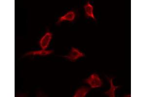 ABIN6268792 staining HeLa by IF/ICC. (Caspase 9 antibody  (Cleaved-Asp330))