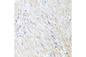 Immunohistochemistry of paraffin-embedded mouse heart using L2HGDH antibody (ABIN5975242) at dilution of 1/100 (40x lens). (L2HGDH antibody)