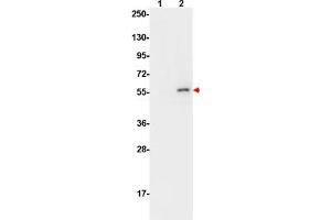 Image no. 6 for anti-V-Akt Murine Thymoma Viral Oncogene Homolog 1 (AKT1) (pSer473) antibody (ABIN1099896) (AKT1 antibody  (pSer473))