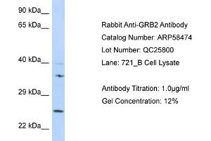 Western Blotting (WB) image for anti-Growth Factor Receptor-Bound Protein 2 (GRB2) (N-Term) antibody (ABIN970833) (GRB2 antibody  (N-Term))
