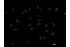 HMX2 antibody  (AA 125-224)