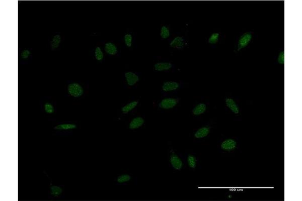 HMX2 antibody  (AA 125-224)