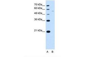 RSRC2 抗体  (AA 363-412)